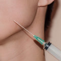 How Far Does the Botox Needle Go? An Expert's Guide