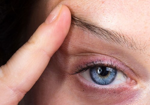 Can Botox Lift Your Eyelids?